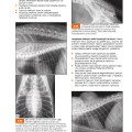 pic11